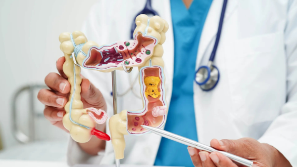 Doctor pointing to a diagram of a colon